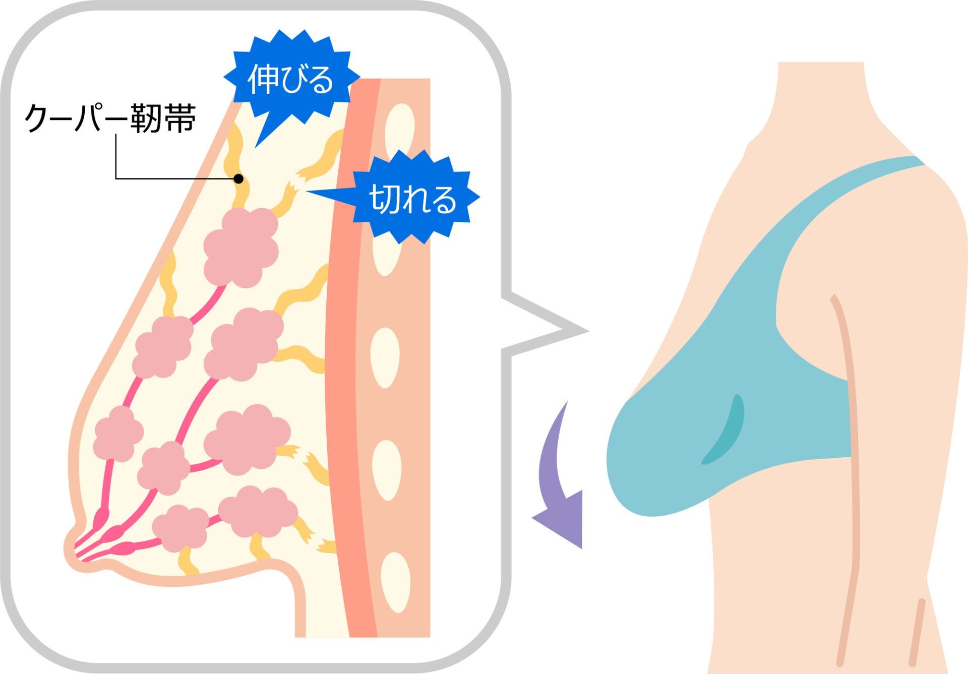 巨乳 走る 痛い