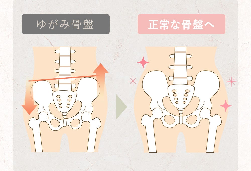 ゆがみ骨盤 正常な骨盤へ