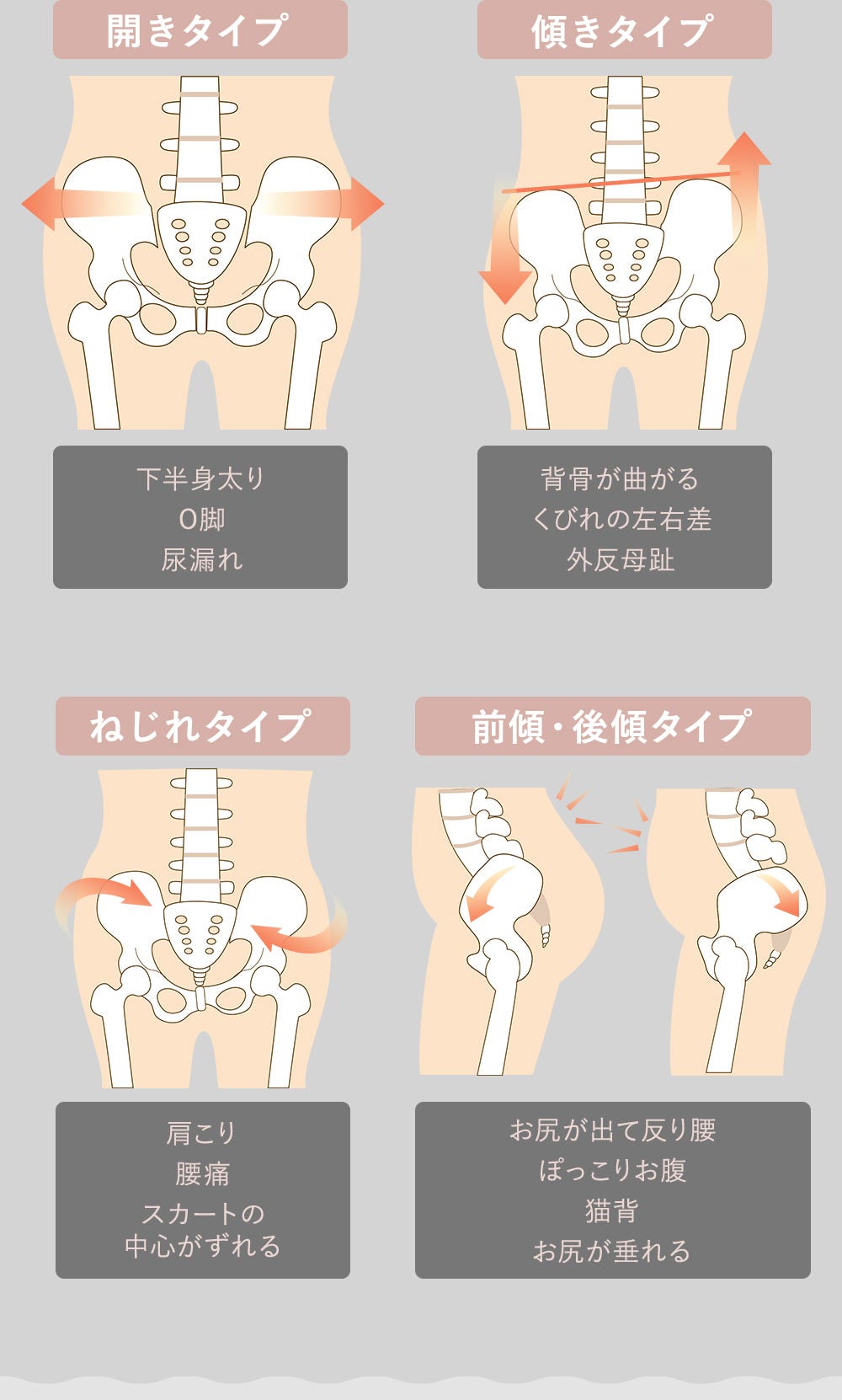 開きタイプ 傾きタイプ ねじれタイプ 前傾・後傾タイプ