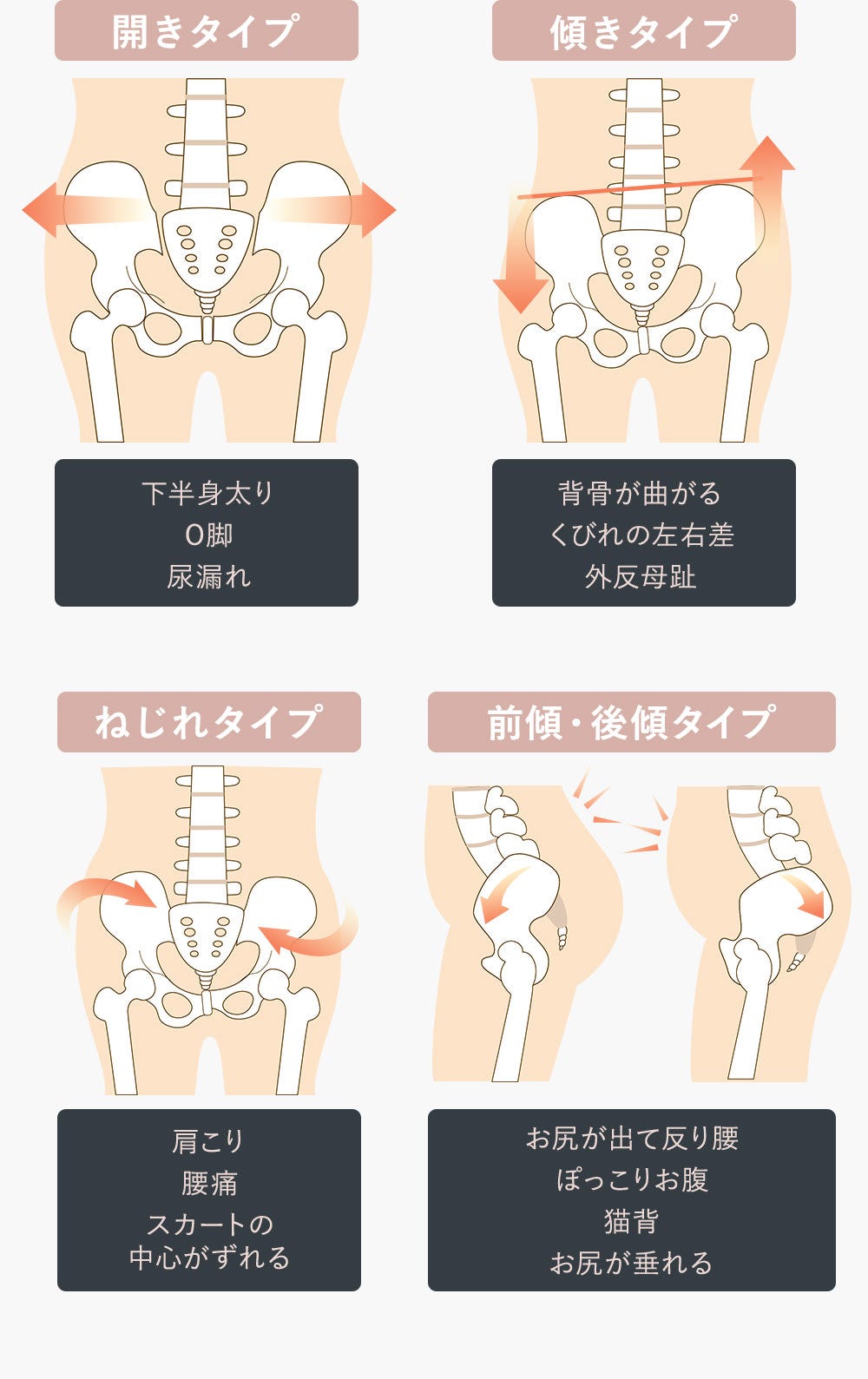 1.開きタイプ 下半身太り、O脚、尿漏れ 2.傾きタイプ 背骨が曲がる、くびれの左右差、外反母趾 3.ねじれタイプ 肩こり、腰痛、スカートの中心がずれる 4.前傾・後傾タイプ お尻が出て反り腰、ぽっこりお腹、猫背、お尻が垂れる