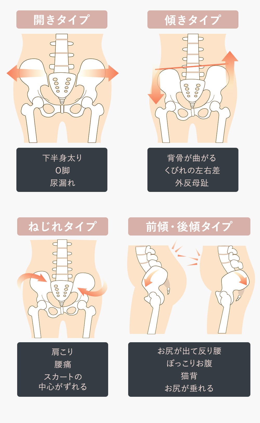 1.開きタイプ 下半身太り、O脚、尿漏れ 2.傾きタイプ 背骨が曲がる、くびれの左右差、外反母趾 3.ねじれタイプ 肩こり、腰痛、スカートの中心がずれる 4.前傾・後傾タイプ お尻が出て反り腰、ぽっこりお腹、猫背、お尻が垂れる